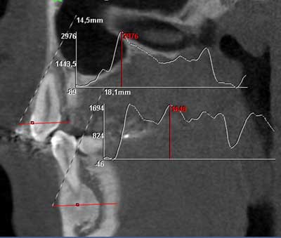 dvt-kfo-36.jpg